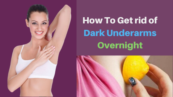 How To Get rid of Dark Underarms Overnight 