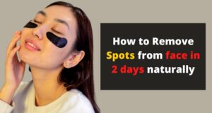 How-to-remove-spots-from-face-in--days-naturally