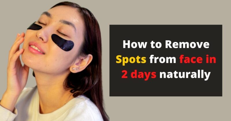 how-to-remove-spots-from-face-in-2-days-naturally