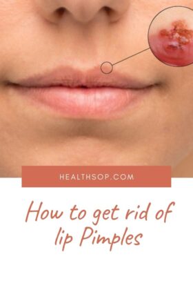 How To get rid of lip Pimples?