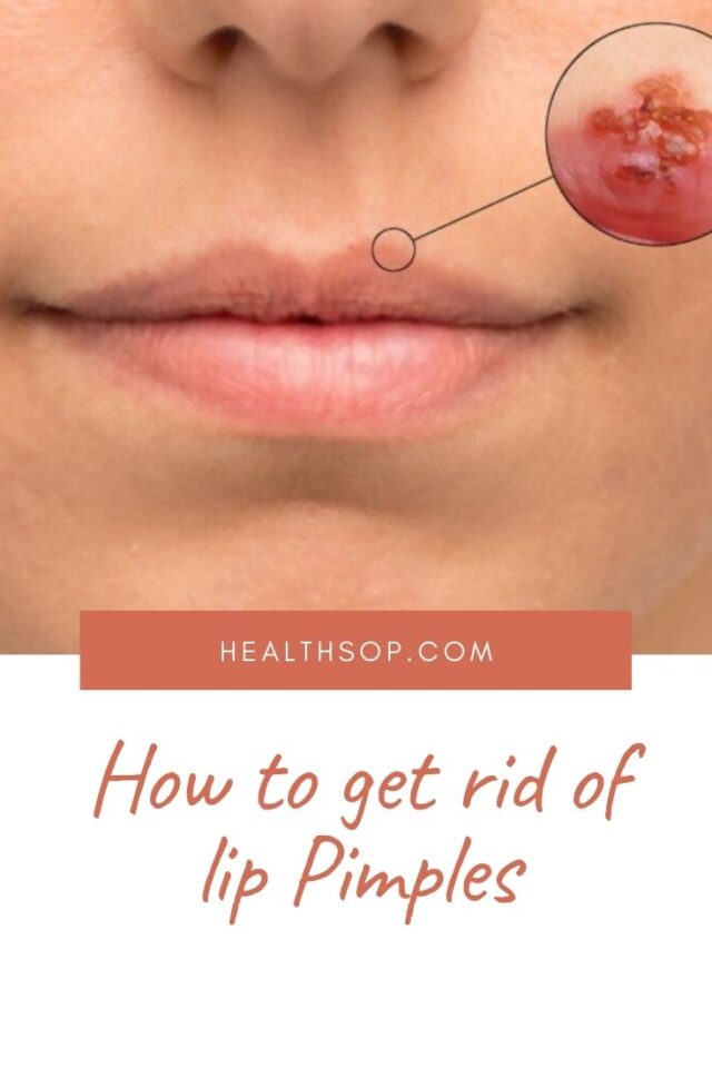 how to get rid of lip pimples asap