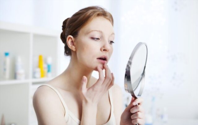 how-to-get-rid-of-lip-pimples