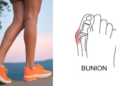 Best walking shoe after bunion surgery Best-walking-shoe-after-bunion-surgery