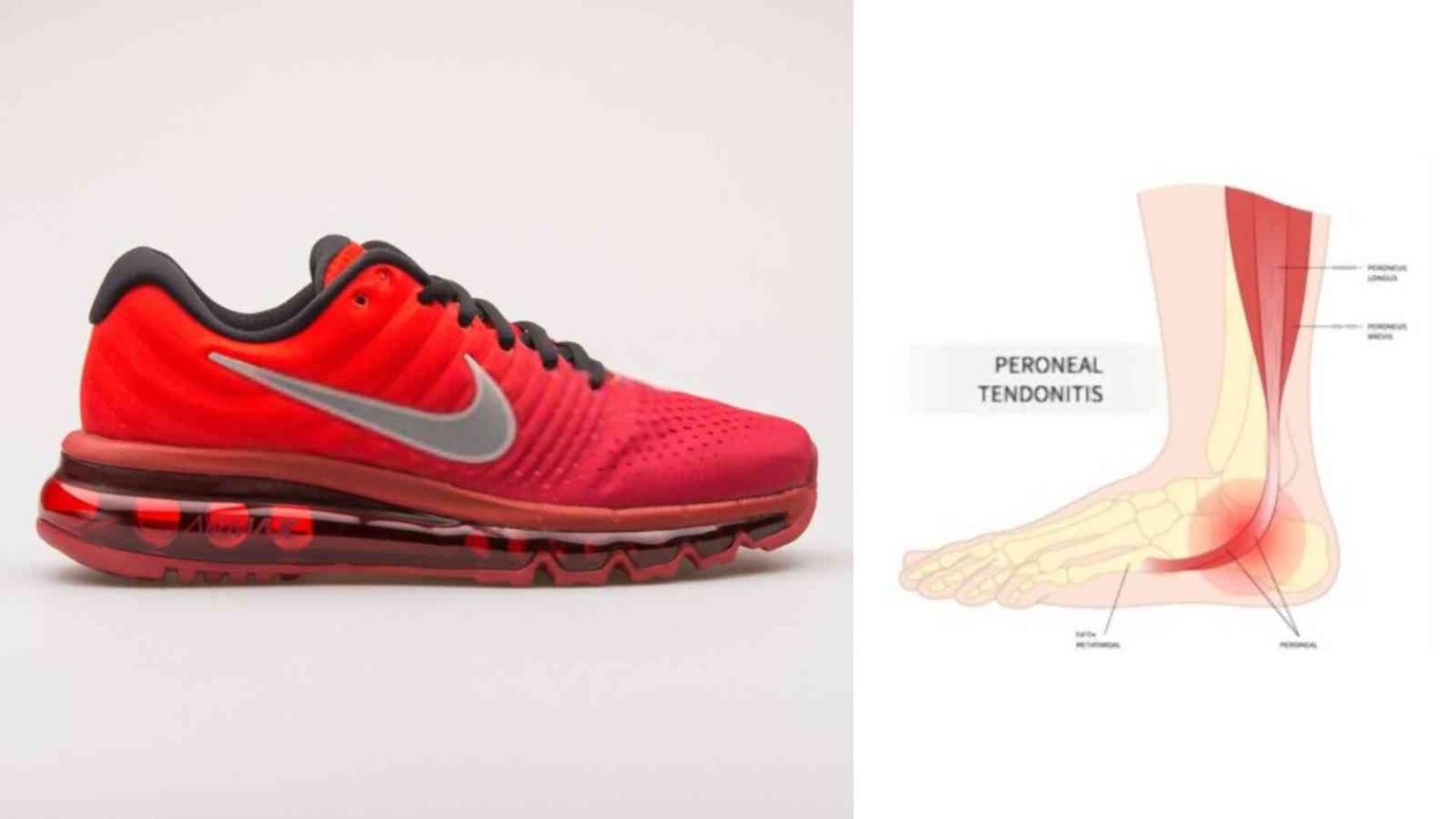 Best Walking Shoes for Posterior Tibial Tendonitis